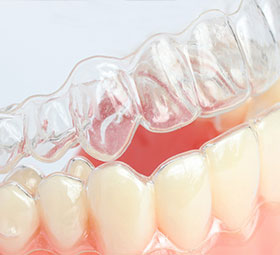 Invisalign in Twin Falls, Idaho